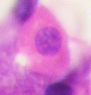 A parietal cell